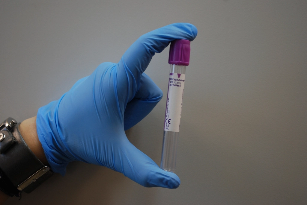 Gloved hand holding a blood collection tube